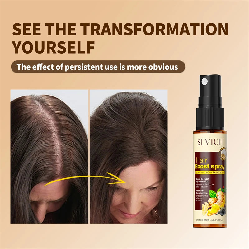 Sevich 30ml Herbal Oil Essence Hair Growth Spray | Hair Care Hair Growth Spray P3