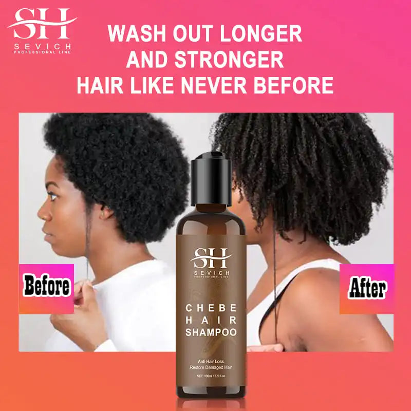 SEVICH Chebe Hair Growth Shampoo & Conditioner Set Hair Care Set P3