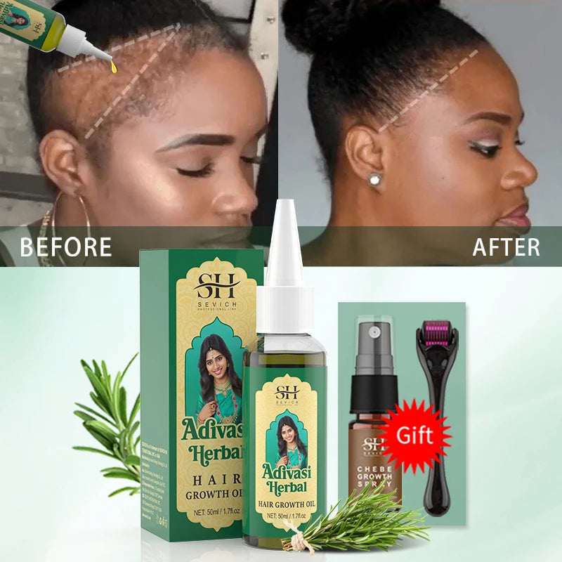 Ayurvedic Adivasi Herbal Hair Growth Oil – 50ml Serum | Sevich Hair Growth Oil P3