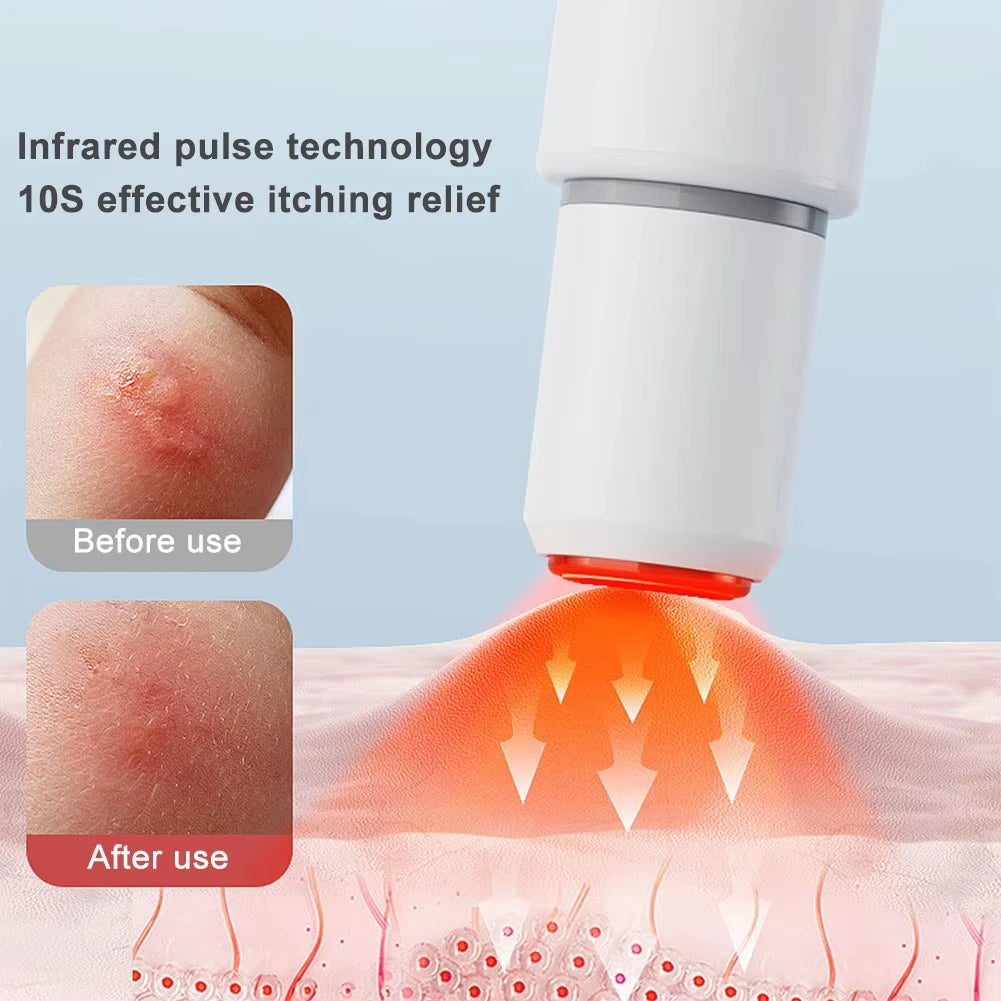 Electronic Mosquito Bite Itch-Relief Pen | Infrared Heat Pen Itch Relief Pen P3