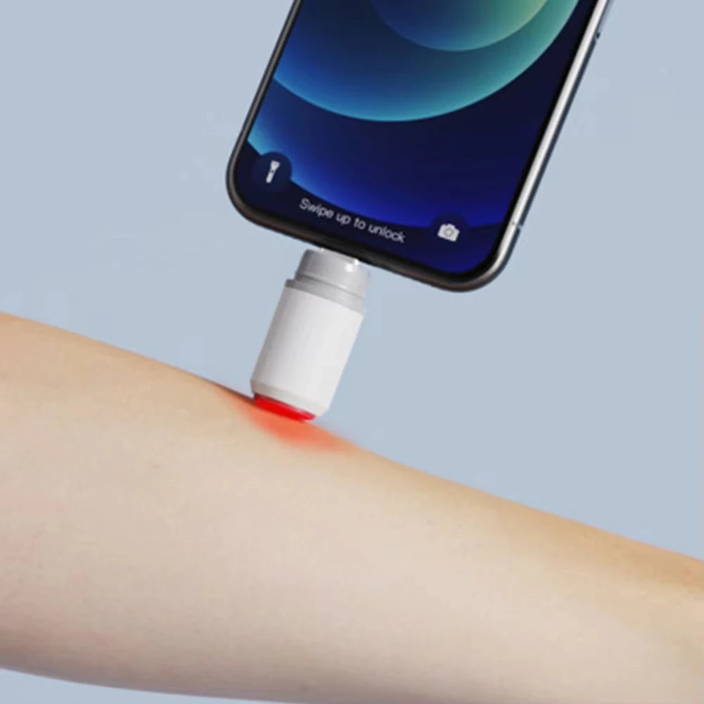 NOCCLILI Electronic Insect Bite Pen | Portable Anti-Itch Device Anti-Itch Bite Pen P3