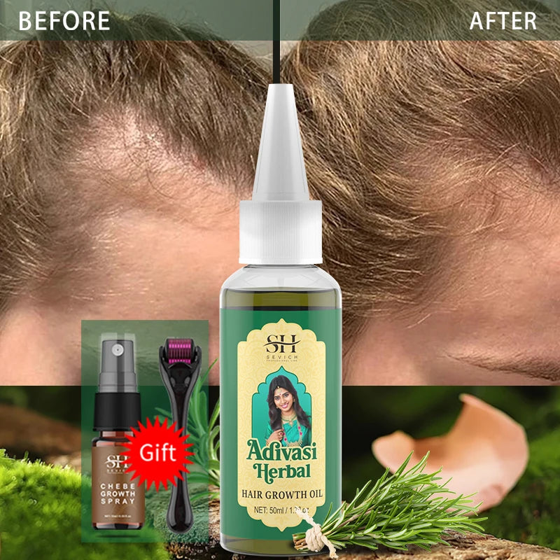 Ayurvedic Adivasi Herbal Hair Growth Oil – 50ml Serum | Sevich Hair Growth Oil P3