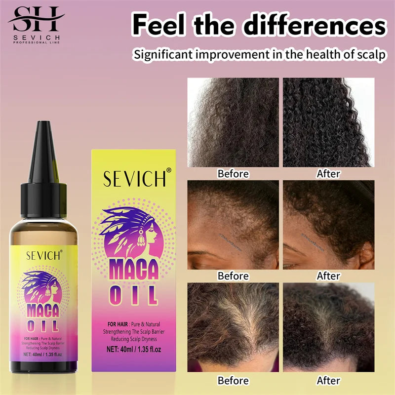 Sevich Maca Root Hair Growth Oil & Butter Set | Castor Oil Hair Growth Set P3